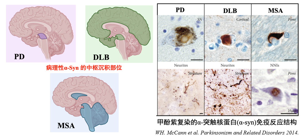α-突触核蛋白超敏检测